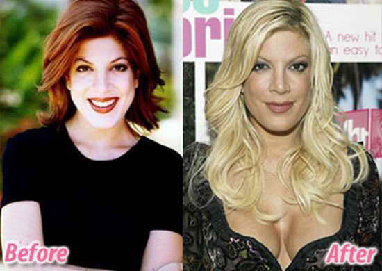 tori-spelling